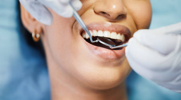Best Emergency Treatment for Oral Infections in Dublin, CA