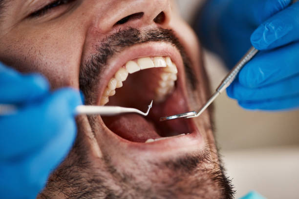 Best Emergency Denture Repair in Dublin, CA